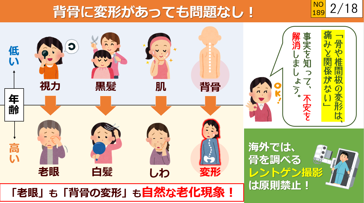 背骨の変形は自然な老化現象なので問題なし