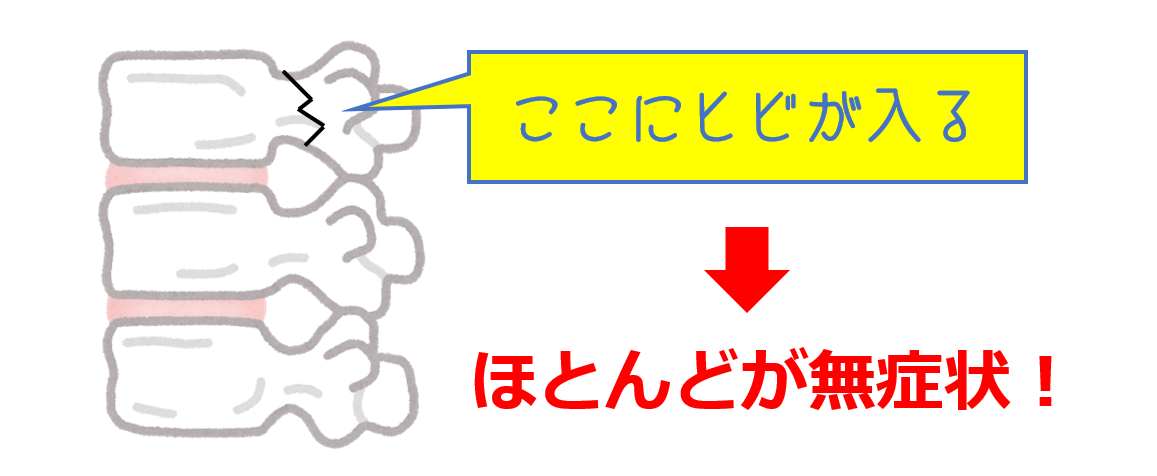 分離症、すべり症とは