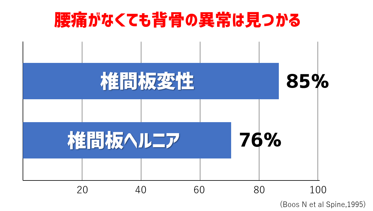 腰痛が無くても椎間板ヘルニアは見つかる